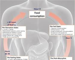 Intermittent Fasting
