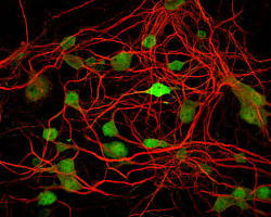 Neural Plasticity