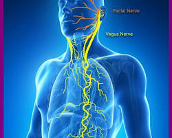 Vagus Nerve