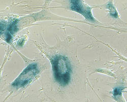 Senescent Cells and Aging Research